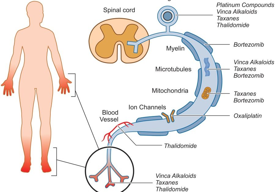 Peripheral Polyneuropathy